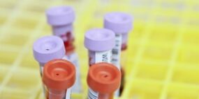 WHAT IS EARLY HIV INFECTION?